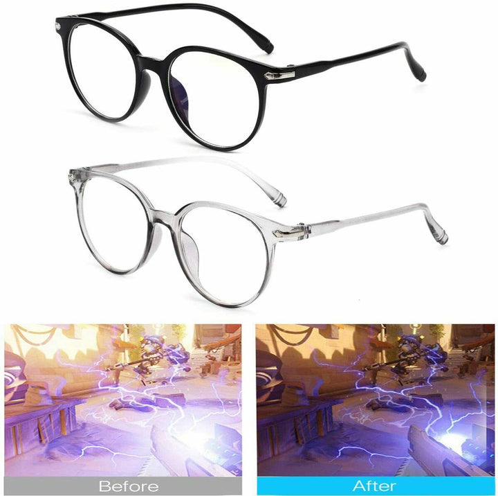 Professional Blue Light Blocking Glasses (Unisex)